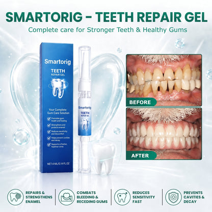 Smartorig - Teeth Repair Gel